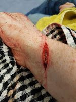 Tis but a scratch